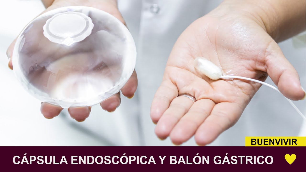 CÁPSULA ENDOSCOPICA Y BALÓN GÁSTRICO -  BUENVIVIR💛 02/05/24 Canal 4