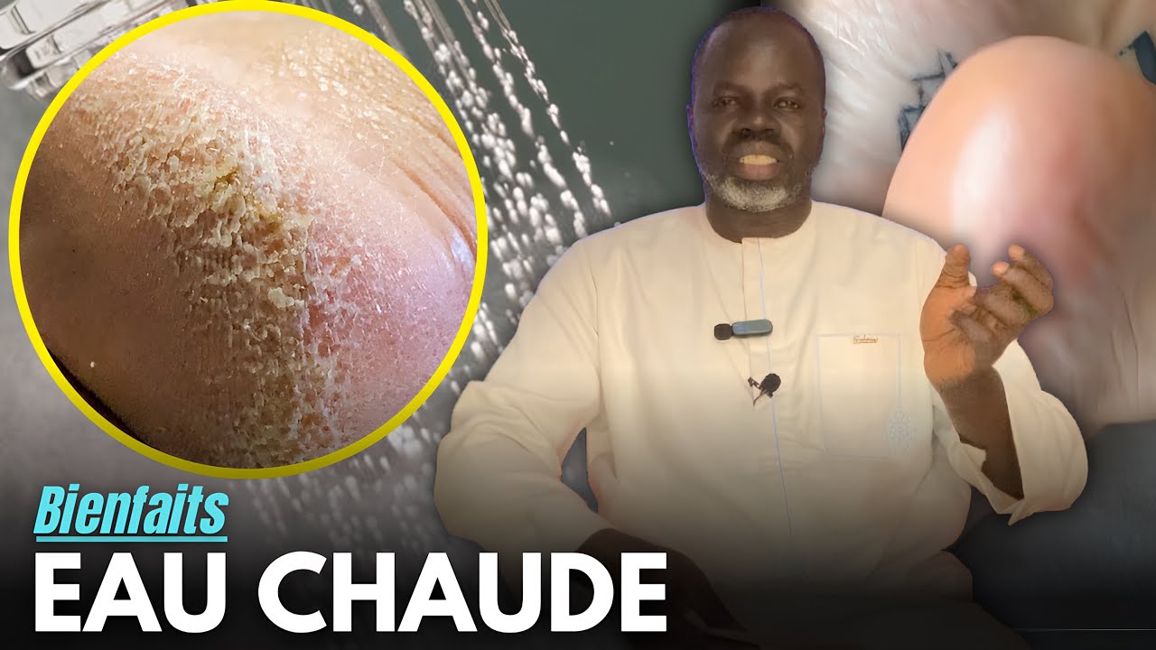 Ndiariniou NDOX BOU TANGUE ( Bienfaits Eau Chaude ) - Pr Ousmane Ndiaye - SAMA XALAA TV