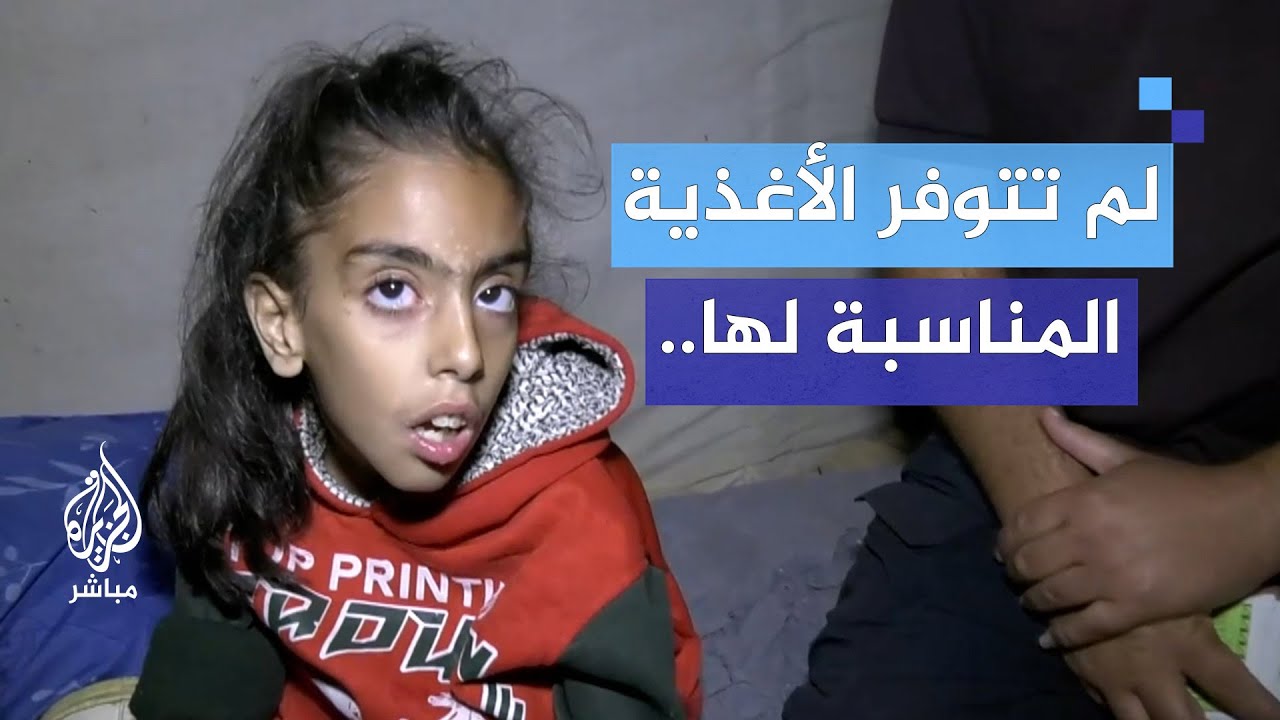 تدهور الحالة الصحية لطفلة نازحة جراء معاناتها من شلل في الدماغ