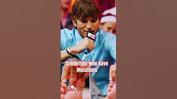 Celebrities Who Have Mutations #shorts