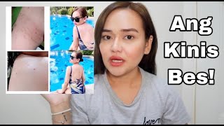 Oxecure Review Effective ba for Acne Prevention Justin Mariel