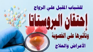 احتقان البروستاتا وتأثيرها علي الخصوبة عند الشباب المقبل علي الزواج وكبار السن