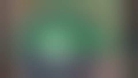 Trans Conjunctival SICS in a Intumescent subluxated Mature Cataract with a non dilating pupil.