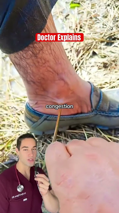 Doctor Reacts: leeches as medicine?!