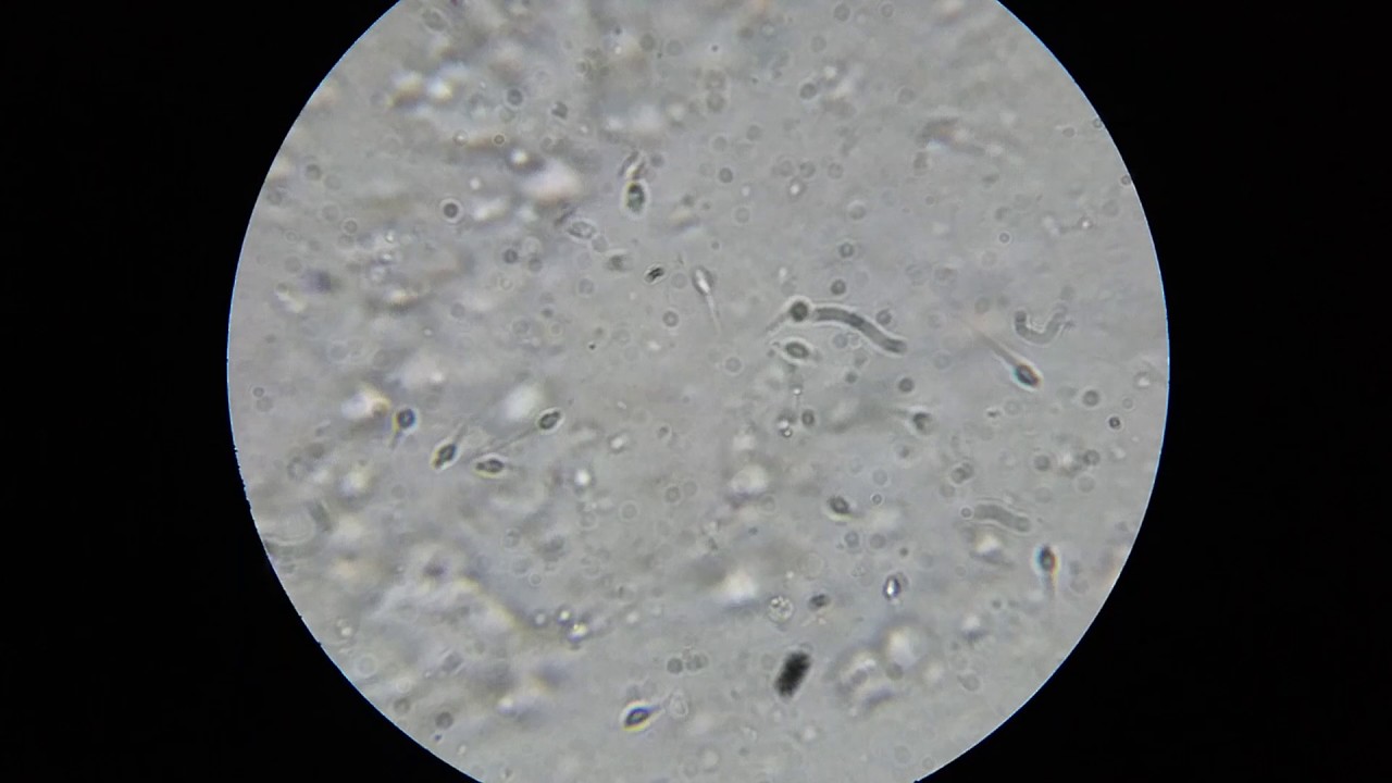顕微鏡で精子を観察 17年8 9月 精子運動性が落ちる日の要因とは