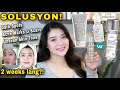 EFFECTIVE WAYS to Lighten Dark Spots, Acne Marks/Scars & Uneven Skin Tone(All Under P500)|May Santos