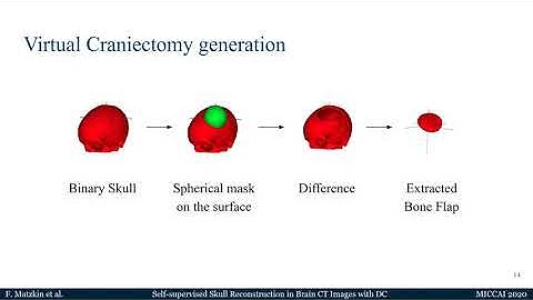 MICCAI 2020 - Self-supervised Skull Reconstruction in Brain CT Images with Decompressive Craniectomy