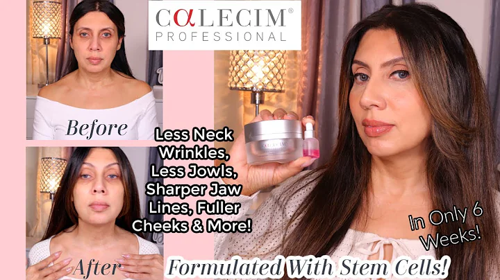 Calecim Professional Serum & Multi-Action Cream Can CHANGE Your Skin!  Stem Cells & Exosomes