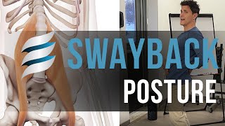 Swayback posture and back pain