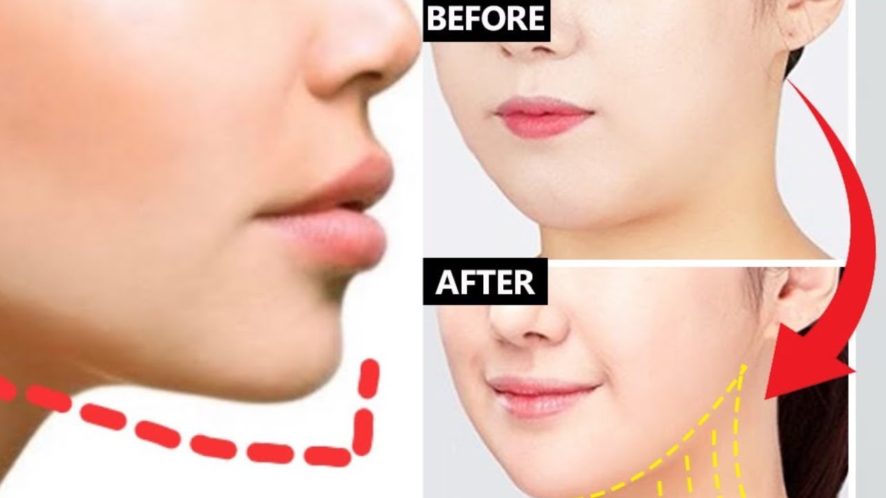 Face Lifting Exercise For JAWLINE, VShaped, Jowls, Sagging Cheeks