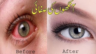 How To Get Clear And Brighten Eyes With 5 Home Remedies Ankhon or Nazar Ka Ilaj