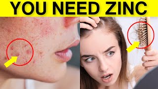 10 Signs of Zinc Deficiency to Never Ignore (ex: Hair Loss, Acne, and infections)