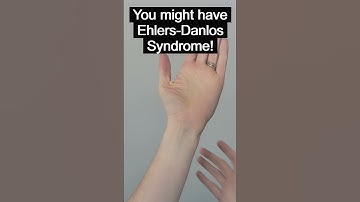 Do you have Arachnodactyly?