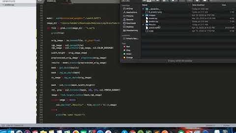 Brain tumor detection using AI