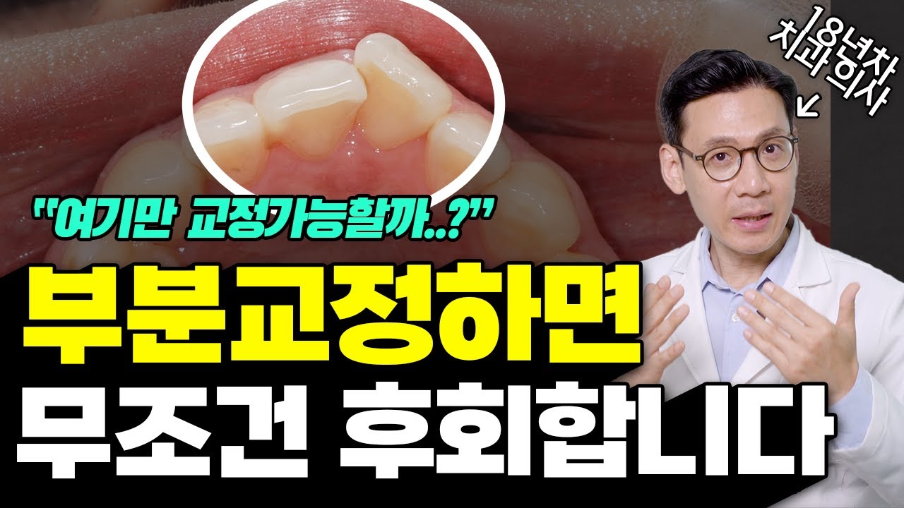 '이런경우' 아니면 부분교정 하지마세요. 부분교정 진단기준 총정리