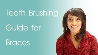Braces Cleaning Routine | Tooth Brushing Guide for Braces screenshot 4