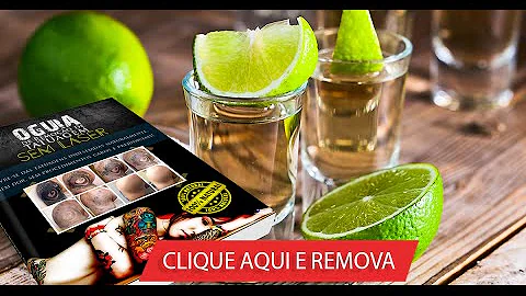 Como remover tatuagem original?