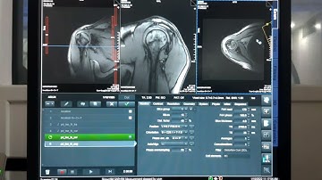 MRI SHOULDER  ||| PLANNING AND PROTOCOL