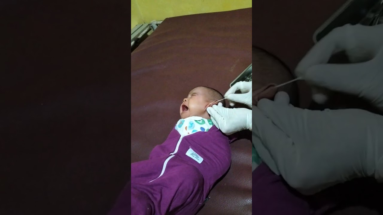 Masya Allah Proses dedek Hanna tindik telinga