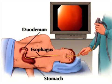 EndoscopyEndoscopyis a routinely done procedure these days. In this video, I talk about basic inform. 