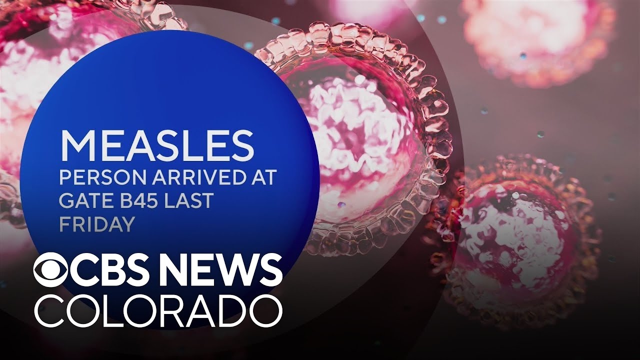Colorado health officials working to contact anyone on the same flight as a person who had measles