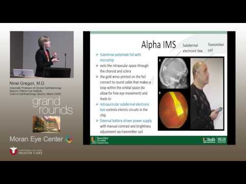 Advances in Artificial Vision: Quest for the Bionic Eye