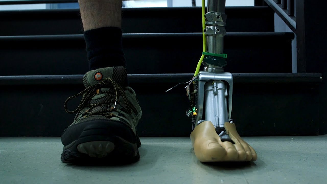 Smart prosthetic ankle takes fear out of rough terrain, stairs