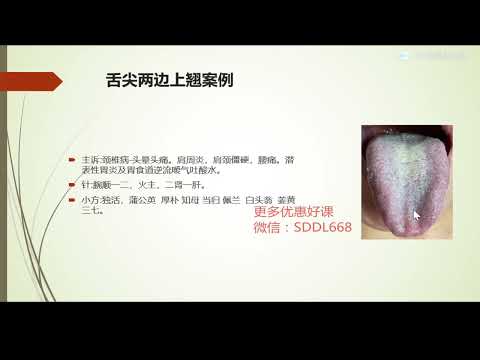 張菁蓉零基礎學舌診44 舌尖兩邊上翹