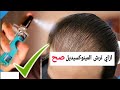 علاج تساقط الشعر بمينوكسيديل 5 Minoxidil في شهر واحد علاج تساقط الشعر بمينوكسيديل 5 Minoxidil في شهر واحد