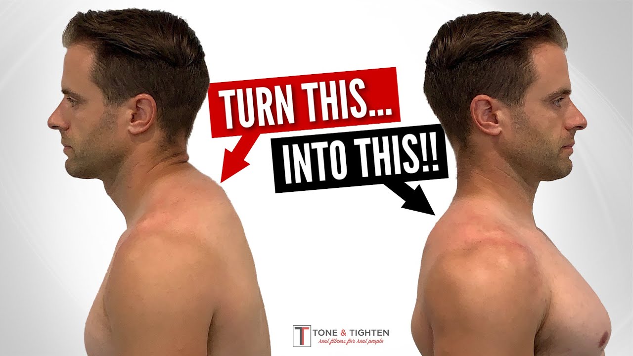 Got a Hump In Your Neck? Here Are Some Tricks to Fix It: Glaser