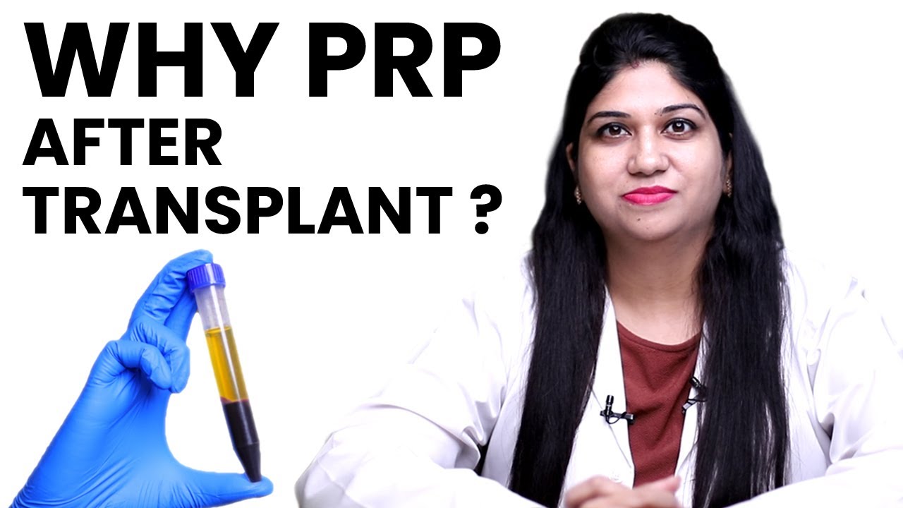 5 Benefits Of PRP After Hair Transplant  | PRP For Hair Loss |
