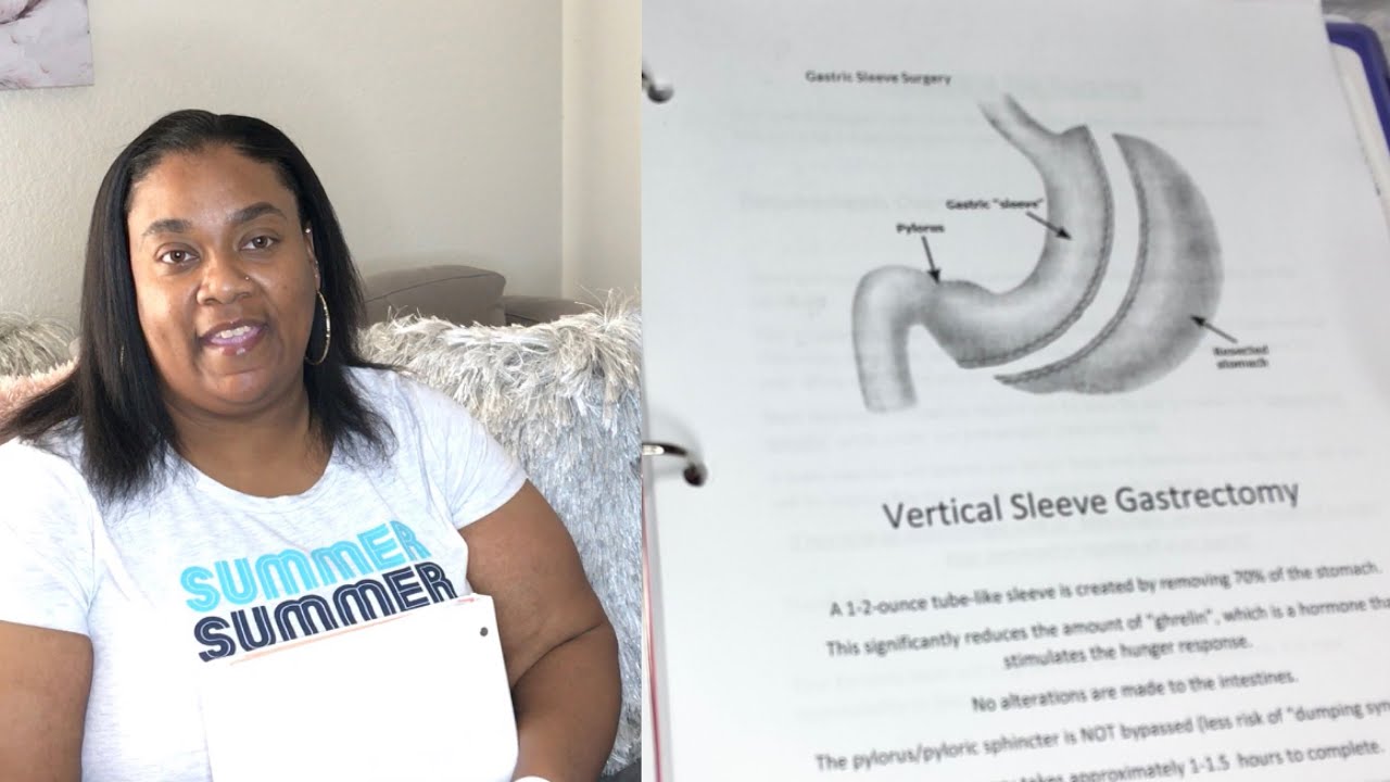 I’m Having Weight Lose Surgery Vertical Sleeve Gastrectomy My VSG Journey 2021 YouTube