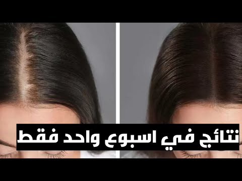 أقوي زيوت لتطويل الشعر أفضل زيوت لأنبات الشعر