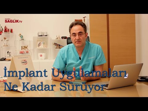 İmplant Uygulamaları Ne Kadar Sürede Tamamlanır - Prof Dr Bülent Kurtiş