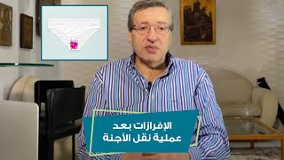 الإفرازات بعد عملية نقل الأجنة