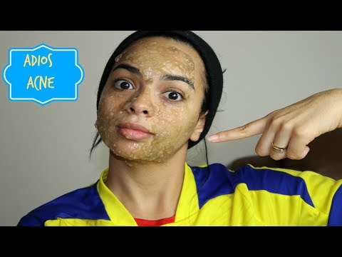 MASCARILLA PARA DESINFLAMAR Y PREVERNIR EL ACNE/ PRISCYBTIMES