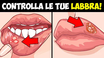 Come far passare bollicina in bocca?