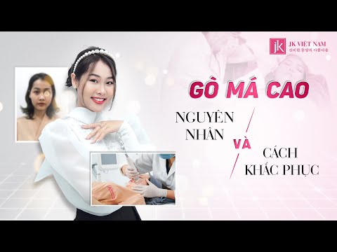 Video Gò Má Cao - Nguyên Nhân và Cách Khắc Phục (Bác Sĩ JK... - youtube