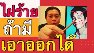 ไฝร้าย 4 จุดบนใบหน้า ถ้ามีแนะนำควรเอาออก by ณัฐ นรรัตน์