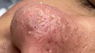 Satisfying and Relaxation with SURI NGUYEN Beauty Spa Video #220