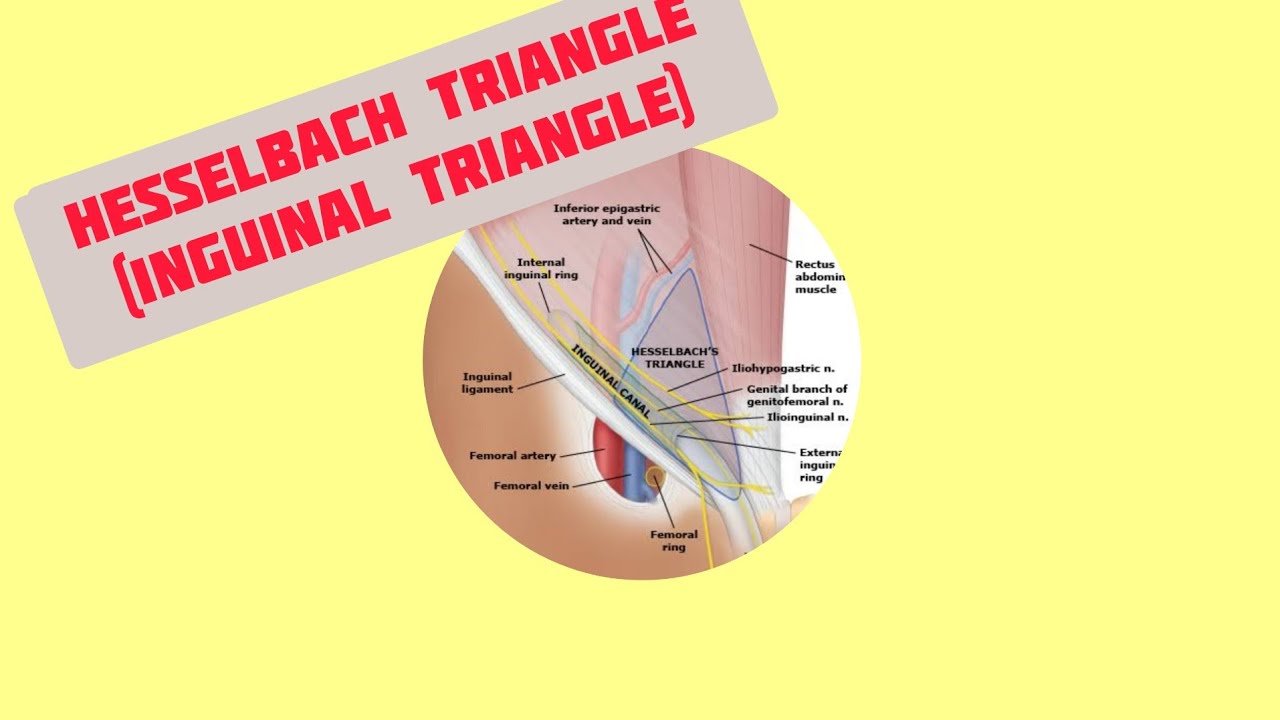 Inguinal Hernia Repair by Dr. David W. Ford