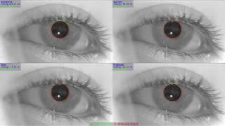An Adaptive Algorithm for Precise Pupil Boundary Detection using Entropy of Contour Gradients