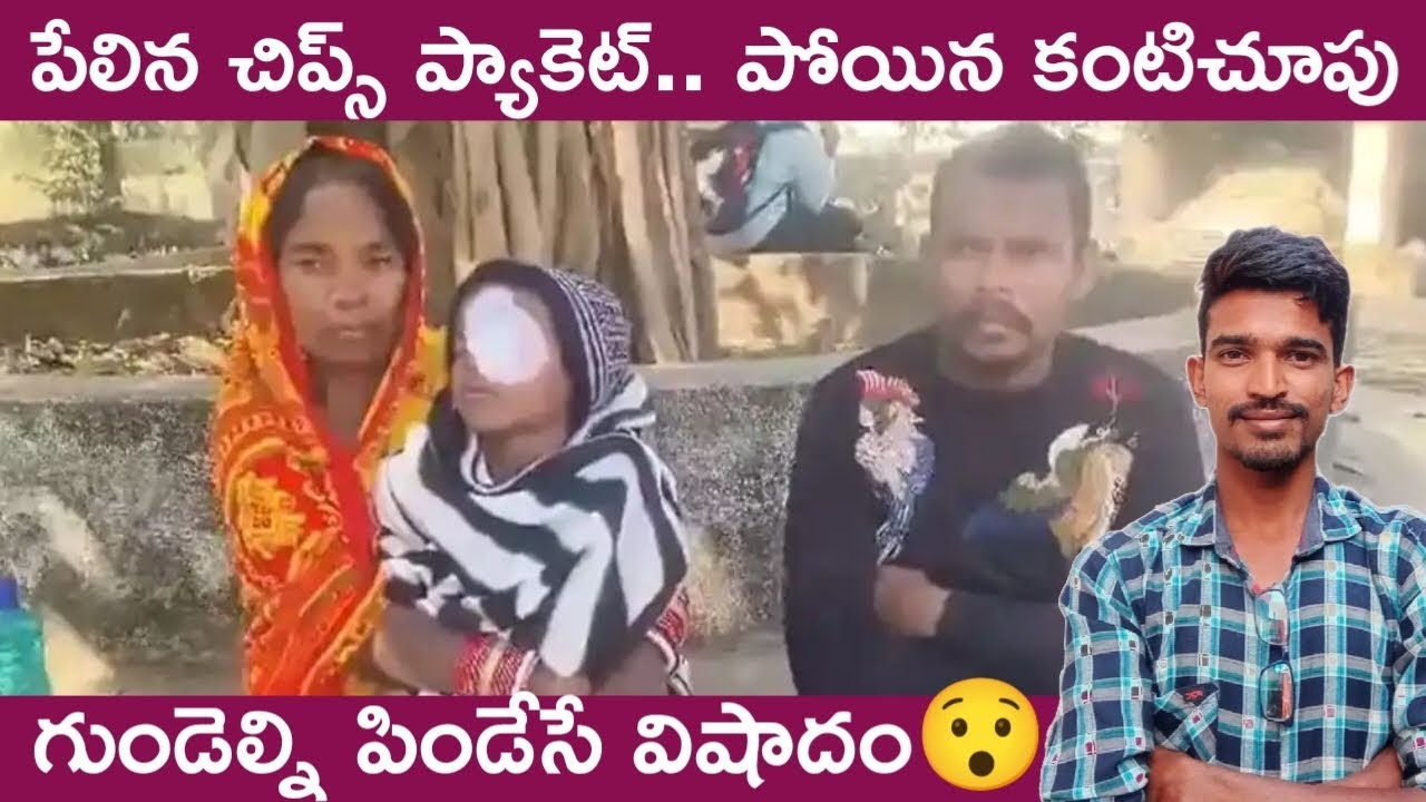 Chips pocket blasted, 8 years old boy lost his eye big breaking news 