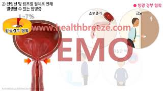 [시연용] c0321aako_[대한비뇨의학회] 개복하 근치적 전립선적출술 안내 [동의서용]