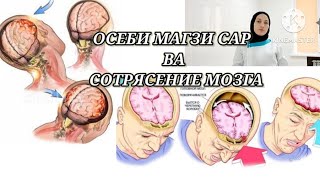 картинка: ОСЕБХОИ МАГЗИ САР ВА СОТРЯСЕНИЕ МОЗГА
