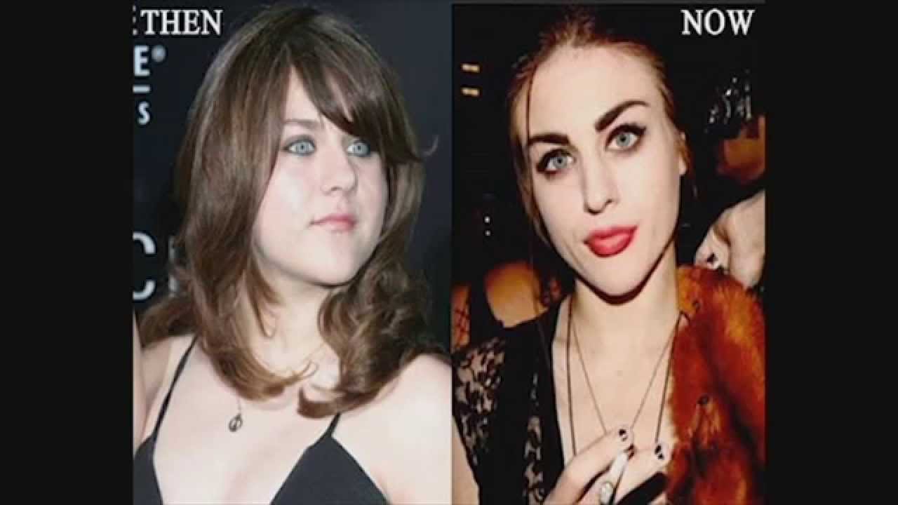 France Bean Cobain Plastic Surgery YouTube france-bean-cobain-plastic-surgery-youtube