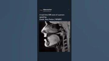 A real time MRI scan of a speaking human,  #human #mriscan #realtime #youtubeshorts