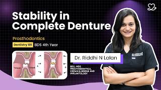 Dentistry 101 | Prosthodontics | Stability in Complete Denture | BDS 4th Year screenshot 5