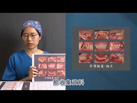 牙周病非手術治療