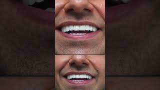 Dental Center Turkey - Istanbul #clinichealthbeauty